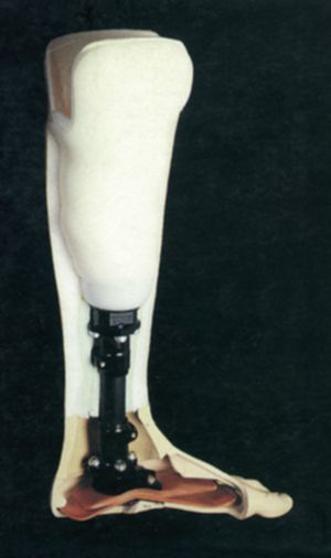 Lower Limbs Prostheses